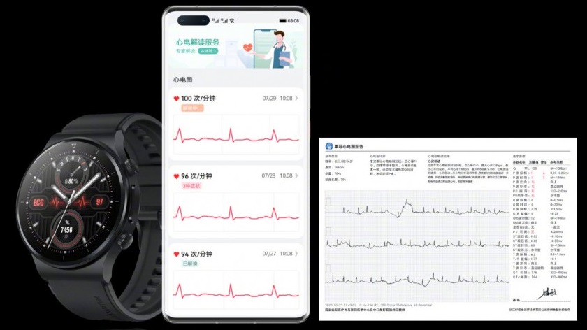 Huawei-Watch-GT-2-Pro-ECG.jpg